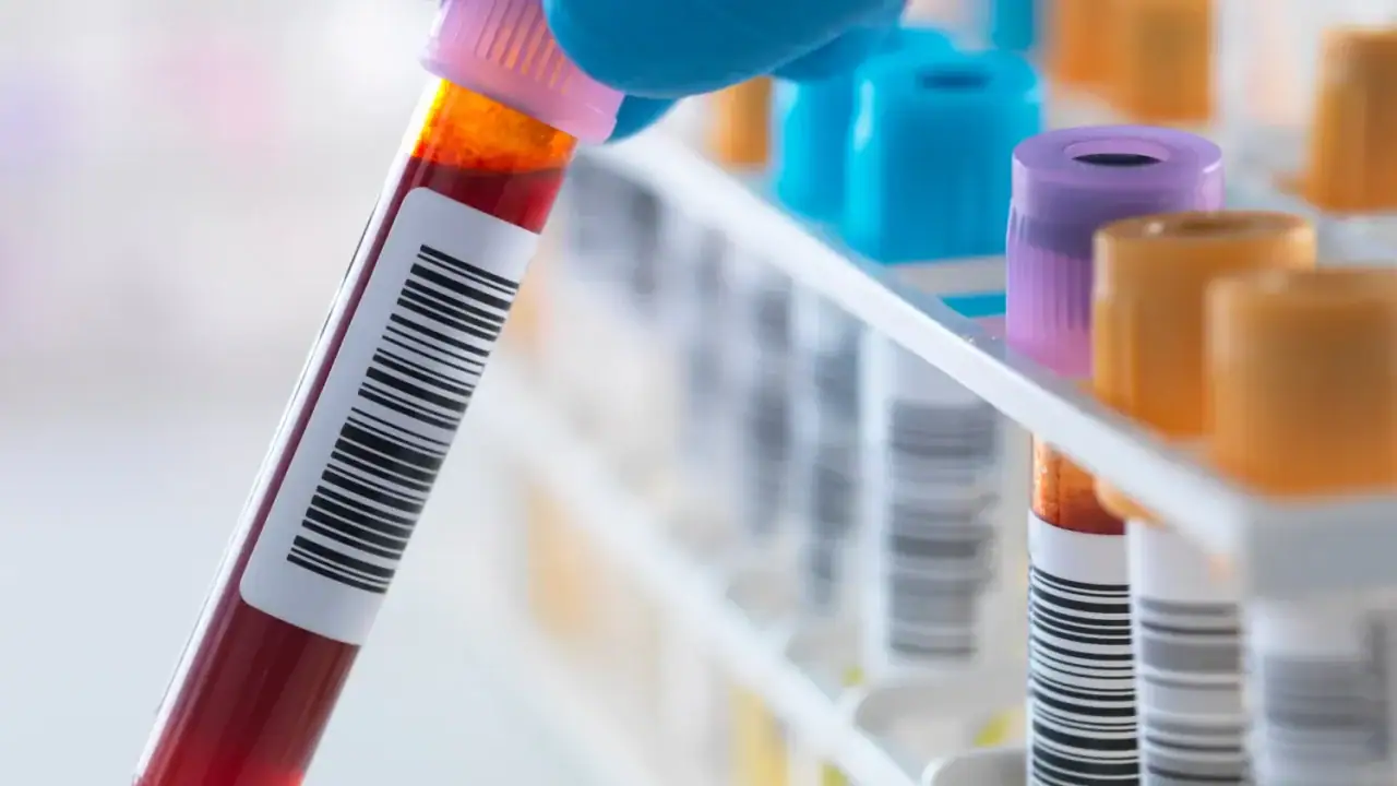 The research project will draw information from 300,000 blood samples